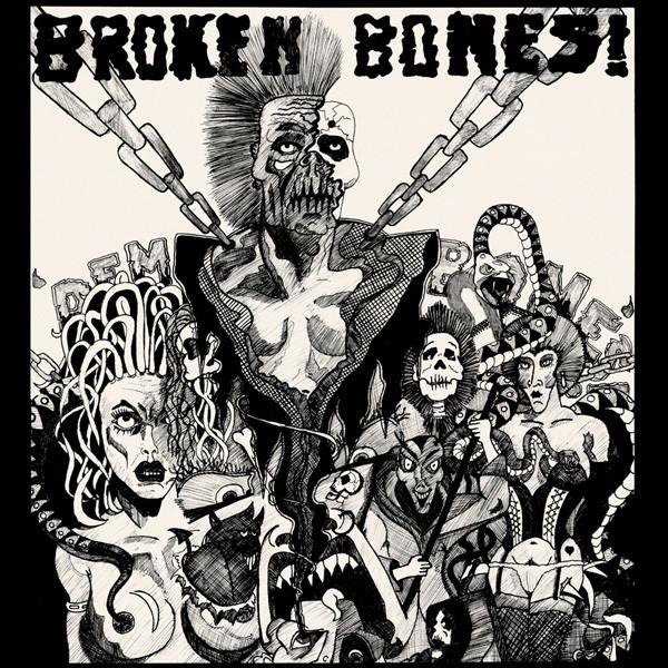 Broken Bones - Dem Bones